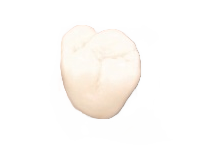 インプラント