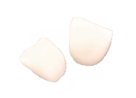 インプラント