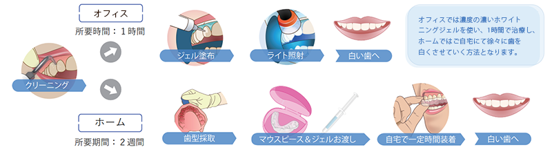 オフィスホワイトニングとホームホワイトニングの違い
